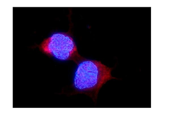 Anti-ALDH2 Antibody