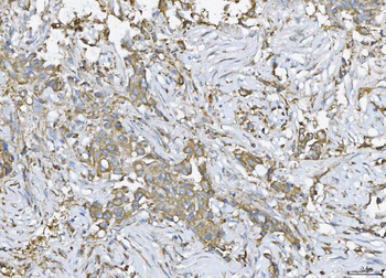 Anti-ATX2/ATXN2 Antibody