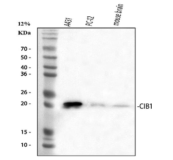Anti-CIB1 Antibody