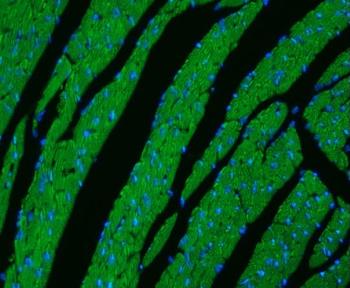 Anti-CPT1B Antibody