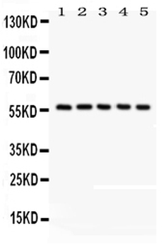 Anti-CREB3L1 Antibody