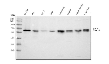 Anti-ICA1 Antibody