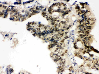 Anti-TCPTP/PTPN2 Antibody