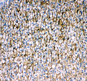 Anti-Scavenging Receptor SR-BI/SCARB1 Antibody