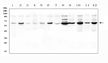 Anti-SLC19A1 Antibody