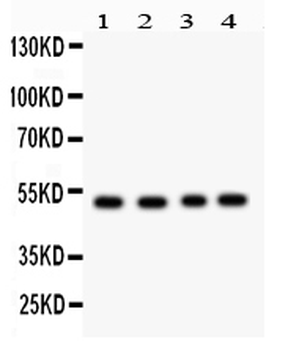 Anti-SOCS4 Antibody