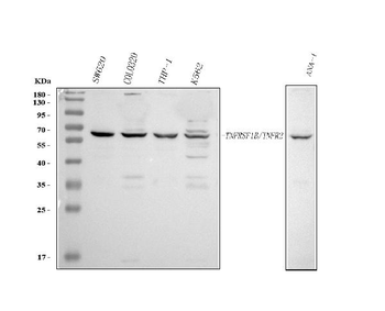 Anti-TNF Receptor II/TNFRSF1B Antibody