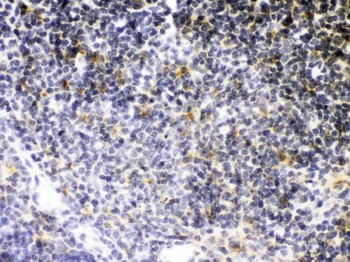 Anti-TNF Receptor II/TNFRSF1B Antibody