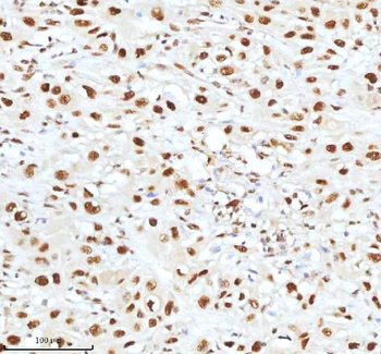Anti-Ku70/XRCC6 Antibody
