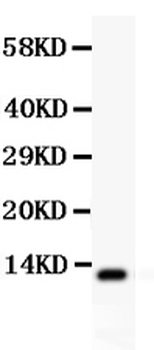 Anti-Estrogen Inducible Protein pS2/TFF1 Antibody