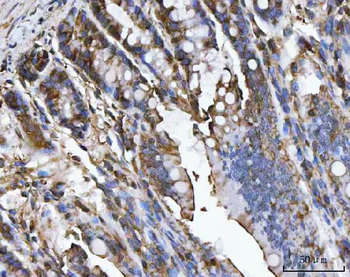 Anti-Carbonic Anhydrase I/CA1 Antibody