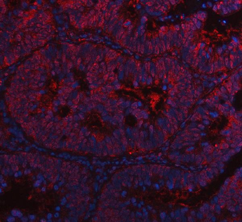 Anti-Cdk4 Antibody