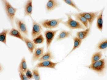 Anti-COMT Antibody