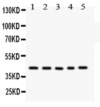Anti-CCN1/CYR61 Antibody