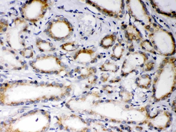 Anti-EBAG9 Antibody
