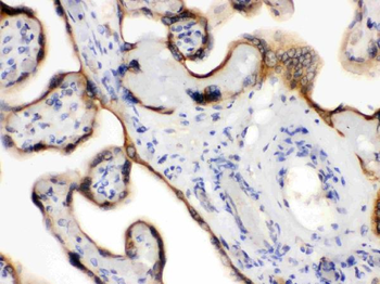 Anti-Endothelin B Receptor/EDNRB Antibody