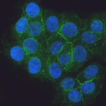 Anti-E Cadherin 1/CDH1 Antibody