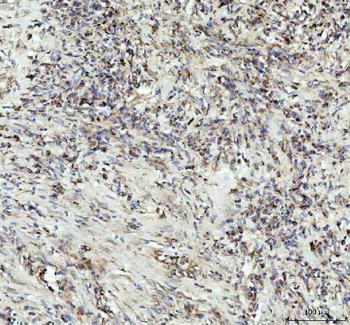 Anti-G-CSF/CSF3 Antibody