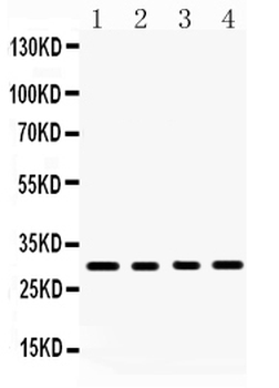 Anti-BAFF/TNFSF13B Antibody
