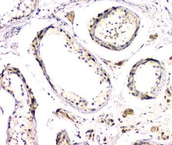 Anti-DMRT1 Antibody