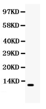 Anti-Eotaxin/CCL11 Antibody