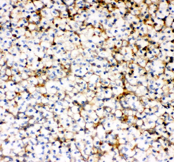 Anti-MCP1/CCL2 Antibody