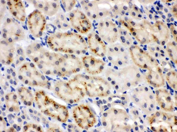 Anti-CRY2 Antibody