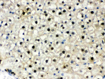 Anti-DDB1 Antibody