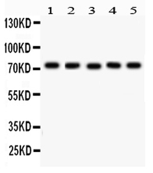 Anti-EED Antibody