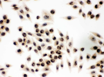 Anti-integrin beta 4 binding protein/EIF6 Antibody