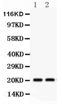 Anti-HSPB2 Antibody