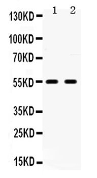 5HT2B Receptor/HTR2B Antibody