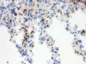 Anti-Lipocalin 2/LCN2 Antibody