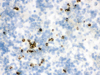 Anti-Lipocalin 2/LCN2 Antibody