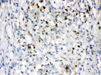 Anti-Lipocalin 2/LCN2 Antibody