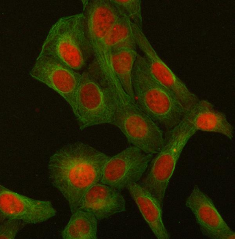 Anti-p95 NBS1/NBN Antibody