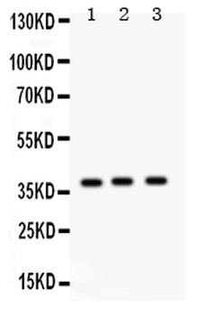 Surfactant protein D/SFTPD Antibody