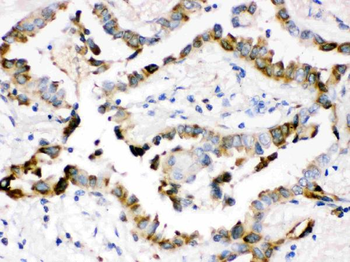 Anti-Surfactant protein D/SFTPD Antibody