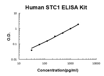 Human Stanniocalcin 1 / STC1 / STC ELISA Kit