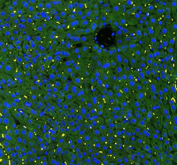 Anti-GSTA1/GSTA2/GSTA3/GSTA4/GSTA5 Antibody