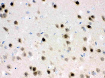 Anti-HDAC11 Antibody
