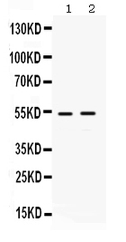 Anti-HSF4 Antibody