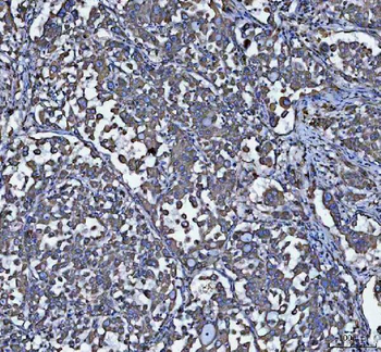 Anti-GRP78 BiP/HSPA5 Antibody