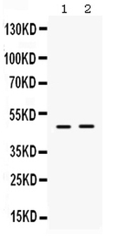 Anti-ING1 Antibody