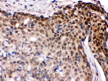Anti-IRF5 Antibody
