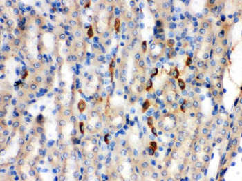 Anti-Kininogen 1/KNG1 Antibody