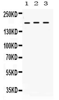 Anti-LIFR Antibody