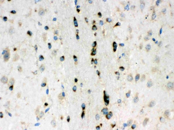 Anti-Lumican Antibody