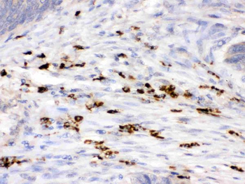 Anti-Lysozyme/LYZ Antibody