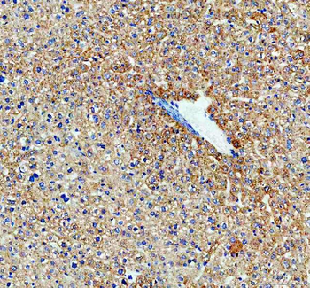 Anti-Monoamine Oxidase B/MAOB Antibody